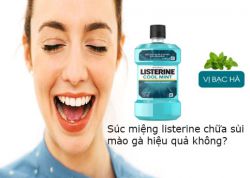 Súc miệng listerine chữa sùi mào gà hiệu quả không? Công dụng có tốt không?