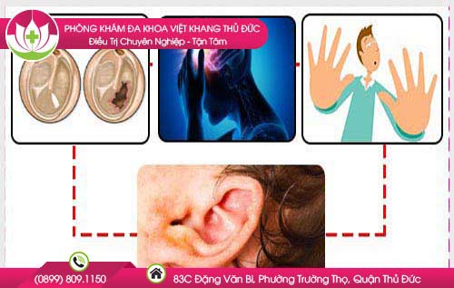 Lỗ tai bị chảy nước vàng gây ra nhiều biến chứng cho người bệnh. 