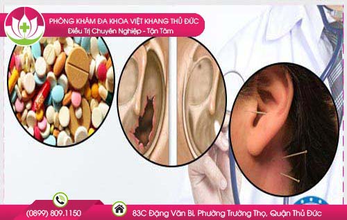 Các phương pháp chữa lỗ tai bị chảy nước vàng. 