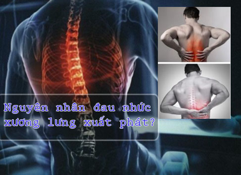 Nguyên nhân đau nhức xương lưng xuất phát? Có cần điều trị không? Phải làm sao mau khỏi?