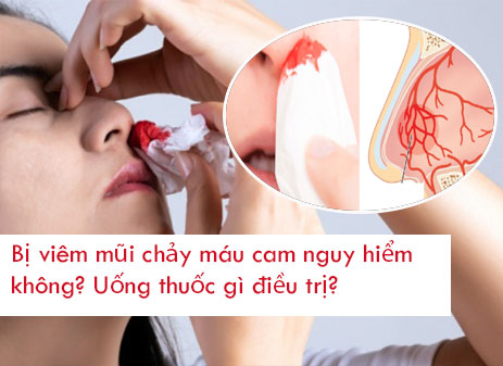 Bị viêm mũi chảy máu cam nguy hiểm không? Uống thuốc gì điều trị?