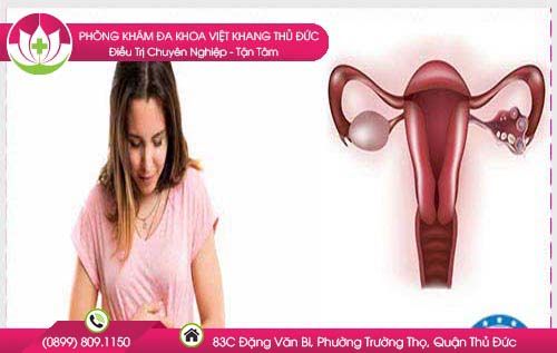 Tìm hiểu về tình trạng viêm nang buồng trứng phải ở phụ nữ.